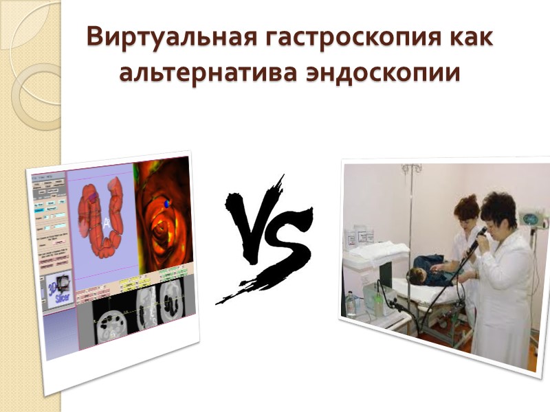 Виртуальная гастроскопия как альтернатива эндоскопии